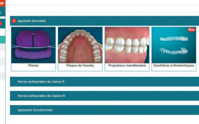 Dental Case : la nouvelle plateforme de présentation de cas bientôt disponible !